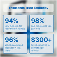 TagBuddy Kit – No More Skin Tags